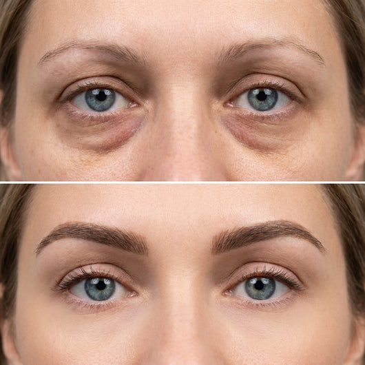 Aviron Fill Eye Cream